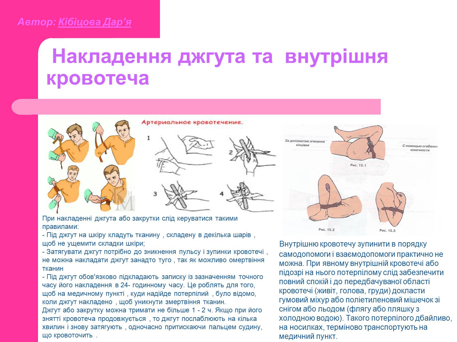 Презентація на тему «Основні принципи порятунку та захисту людей» - Слайд #10 Презентація на тему «Основні принципи порятунку та захисту людей» - Слайд #10
