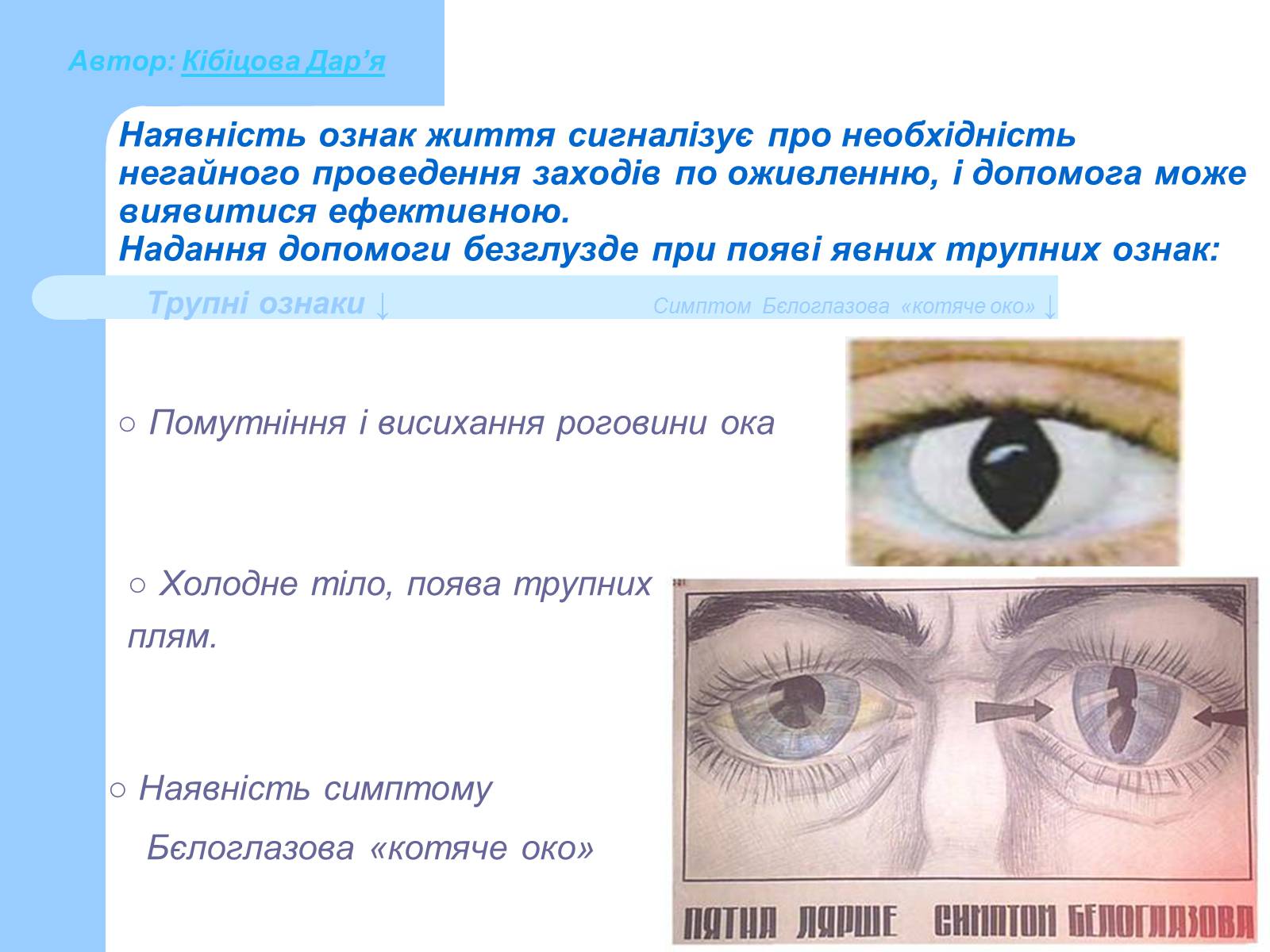 Презентація на тему «Основні принципи порятунку та захисту людей» - Слайд #6 Презентація на тему «Основні принципи порятунку та захисту людей» - Слайд #6