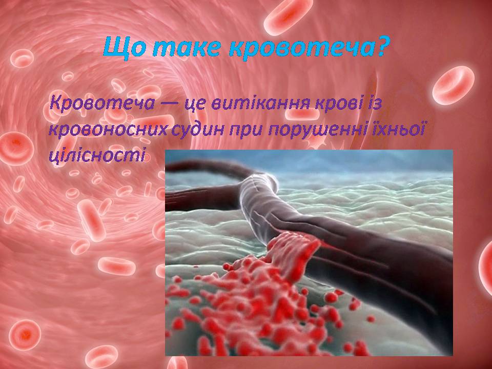 Презентація на тему «Перша допомога при кровотечах» (варіант 2) - Слайд #4 Презентація на тему «Перша допомога при кровотечах» (варіант 2) - Слайд #4