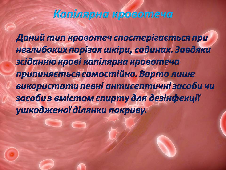 Презентація на тему «Перша допомога при кровотечах» (варіант 2) - Слайд #8 Презентація на тему «Перша допомога при кровотечах» (варіант 2) - Слайд #8