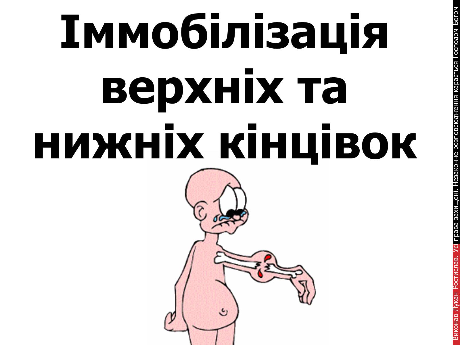 Презентація на тему «Іммобілізація верхніх та нижніх кінцівок» - Слайд #1 Презентація на тему «Іммобілізація верхніх та нижніх кінцівок» - Слайд #1