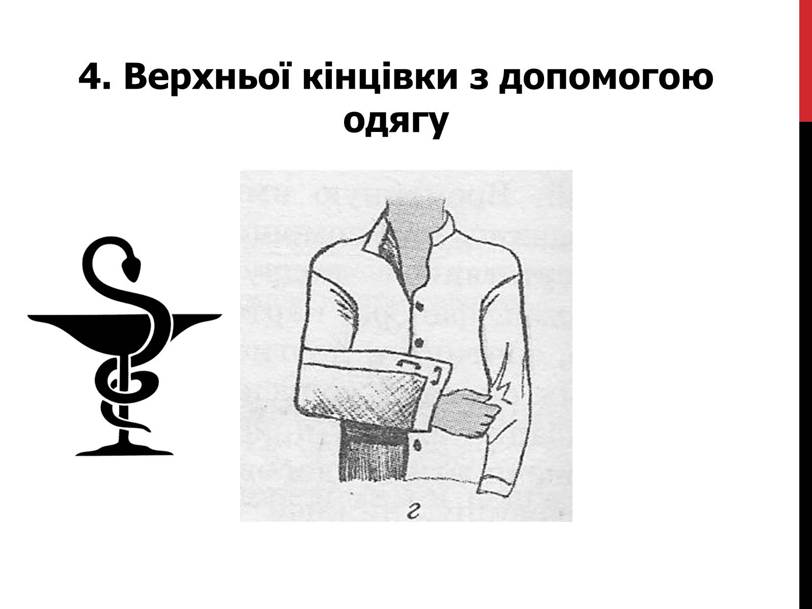 Презентація на тему «Іммобілізація верхніх та нижніх кінцівок» - Слайд #8 Презентація на тему «Іммобілізація верхніх та нижніх кінцівок» - Слайд #8