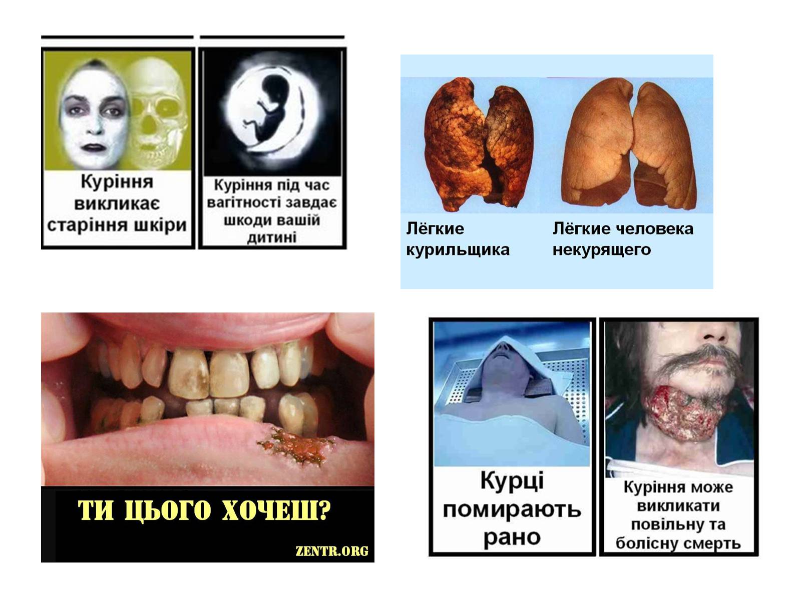 Презентація на тему «Правда про куріння» - Слайд #8 Презентація на тему «Правда про куріння» - Слайд #8
